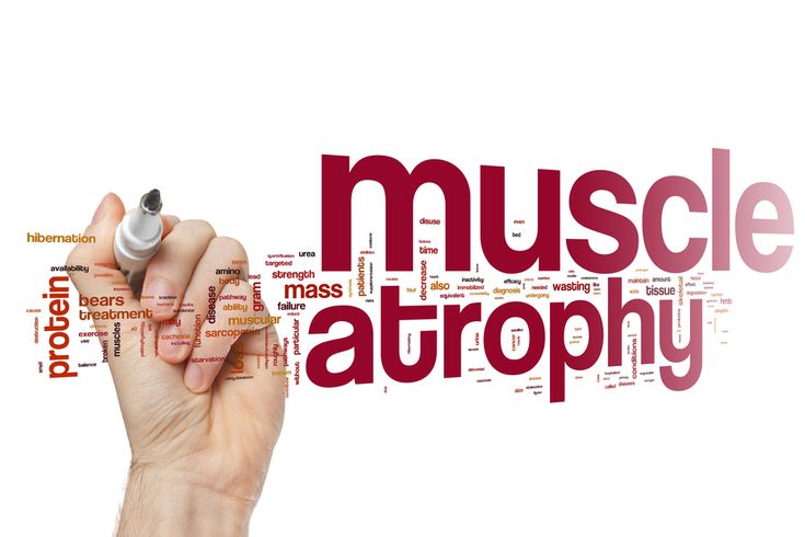 Muscle Atrophy