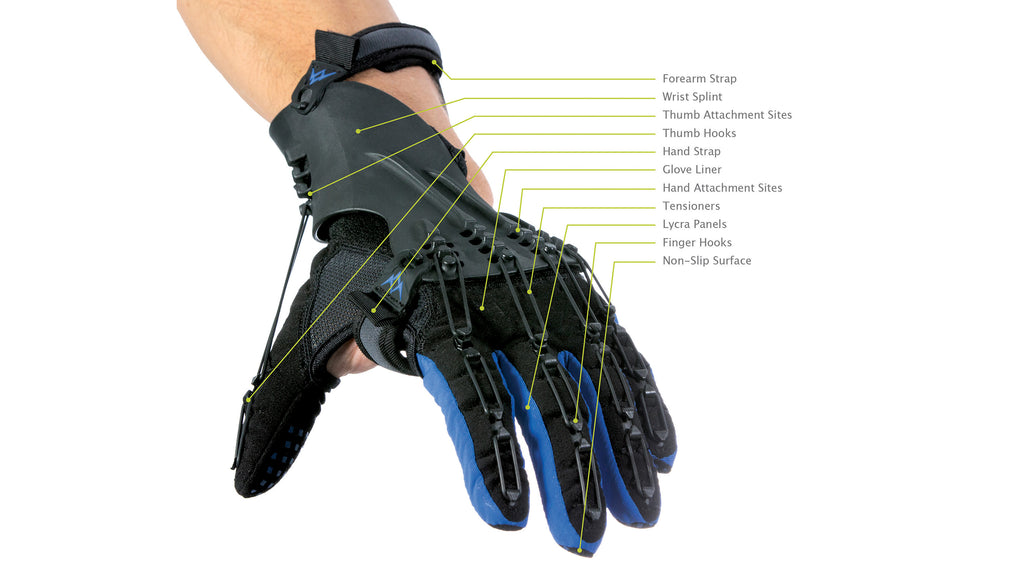 The Amazing SaeboGlove combined with Electrical Muscle Stimulation is the Recipe for Success